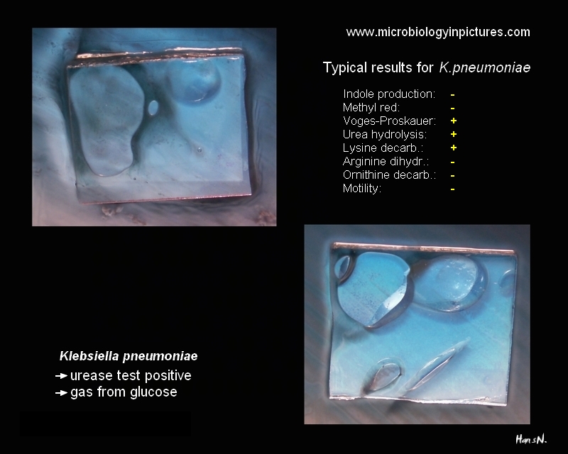 Klebsiella pneumoniae urea hydrolysis